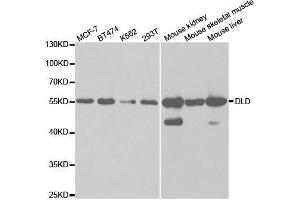Western blot analysis of extracts of various cell lines, using DLD antibody. (DLD antibody  (AA 36-300))
