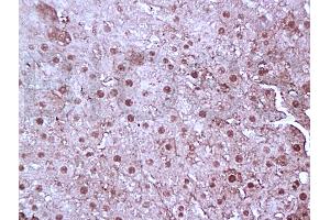 Formalin-fixed and paraffin embedded rat liver tissue labeled with Anti-FoxP3 Polyclonal Antibody, Unconjugated (ABIN727040) at 1:100, followed by conjugation to the secondary antibody and DAB staining (FOXP3 antibody)