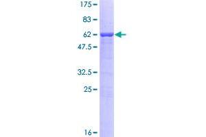 Image no. 1 for Tumor Necrosis Factor (Ligand) Superfamily, Member 13b (TNFSF13B) (AA 1-285) protein (GST tag) (ABIN1323224)