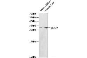Western blot analysis of extracts of various cell lines using EBAG9 Polyclonal Antibody at dilution of 1:1000. (RCAS1 antibody)