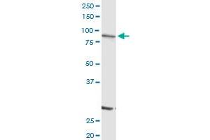 SCIN MaxPab rabbit polyclonal antibody. (Scinderin antibody  (AA 1-468))