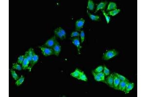 Immunofluorescent analysis of HepG2 cells using ABIN7152394 at dilution of 1:100 and Alexa Fluor 488-congugated AffiniPure Goat Anti-Rabbit IgG(H+L) (FCHO2 antibody  (AA 100-203))