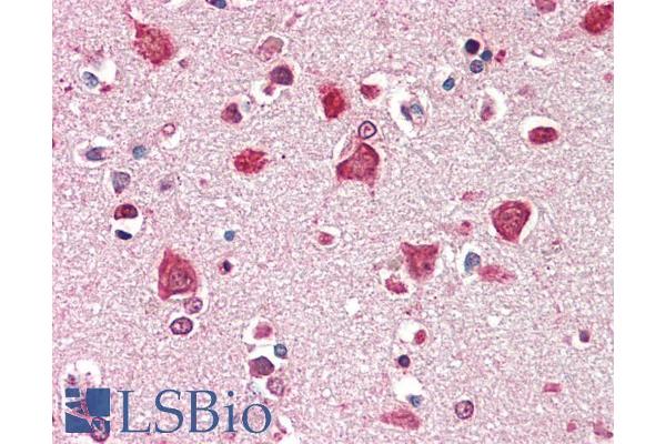 SDCCAG8 antibody  (AA 469-483)
