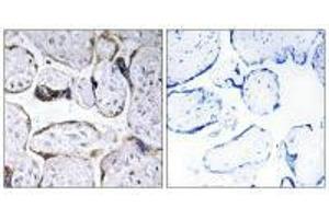 Immunohistochemistry analysis of paraffin-embedded human placenta tissue using ELOVL3 antibody. (ELOVL3 antibody)