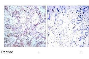 Image no. 1 for anti-Nuclear Factor-kB p65 (NFkBP65) (AA 534-538) antibody (ABIN197116) (NF-kB p65 antibody  (AA 534-538))
