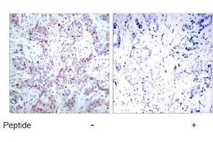 Image no. 1 for anti-Nuclear Factor-kB p65 (NFkBP65) (AA 534-538) antibody (ABIN197117) (NF-kB p65 antibody  (AA 534-538))