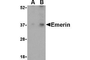 Western blot analysis of Emerin in human skeletal muscle tissue lysate with Emerin antibody at (A) 0. (Emerin antibody  (N-Term))