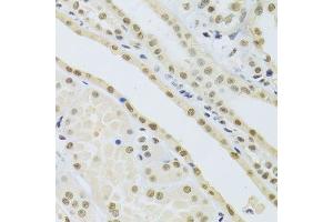 Immunohistochemistry of paraffin-embedded human kidney using DDB1 Antibody. (DDB1 antibody)