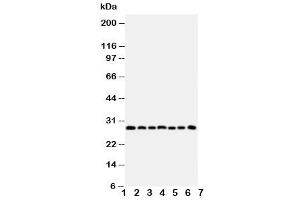 Western blot testing of Kallikrein-11 antibody and Lane 1:  U87