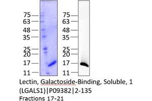 Western Blotting (WB) image for Lectin, Galactoside-Binding, Soluble, 1 (LGALS1) (AA 2-135) protein (His tag) (ABIN3082982) (LGALS1/Galectin 1 Protein (AA 2-135) (His tag))