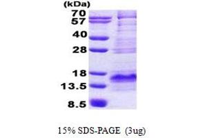 SDS-PAGE (SDS) image for Brain Expressed, X-Linked 1 (BEX1) (AA 1-125) protein (His tag) (ABIN6387227)