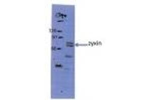 Sample Type: HeLa whole cell lysatePrimary Dilution: 1:200 ZYX is strongly supported by BioGPS gene expression data to be expressed in Human HeLa cells (ZYX antibody  (Middle Region))