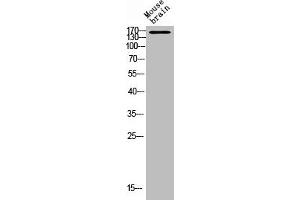 Western Blot analysis of MOUSE-BRAIN cells using DAPK1 Polyclonal Antibody (DAP Kinase 1 antibody)