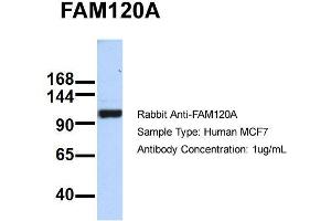 Host: Rabbit   Target Name: FAM120A   Sample Tissue: MCF7  Antibody Dilution: 1. (FAM120A antibody  (Middle Region))
