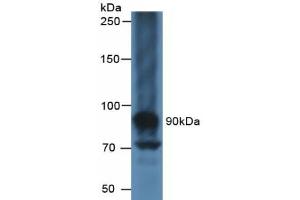 Detection of CA125 in Human Liver Tissue using Polyclonal Antibody to Carbohydrate Antigen 125 (CA125) (MUC16 antibody  (AA 13977-14117))