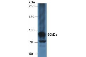 Detection of CA125 in Human Liver Tissue using Polyclonal Antibody to Carbohydrate Antigen 125 (CA125)