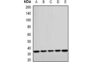 Western blot analysis of ETFA expression in A549 (A), HepG2 (B), mouse kidney (C), mouse heart (D), rat liver (E) whole cell lysates.