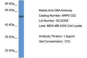 Western Blotting (WB) image for anti-Glucosidase, Beta, Acid (GBA) (C-Term) antibody (ABIN2788767) (GBA antibody  (C-Term))