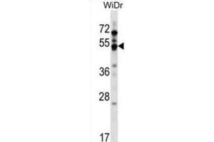 Western Blotting (WB) image for anti-G Protein-Coupled Receptor 84 (GPR84) antibody (ABIN2999428) (GPR84 antibody)