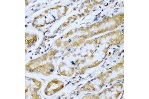 Immunohistochemical analysis of SUFU staining in human stomach formalin fixed paraffin embedded tissue section. (SUFUH antibody)