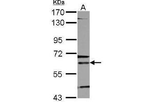 WB Image Sample (30 ug of whole cell lysate) A: K562 7. (ALAS2 antibody  (Center))
