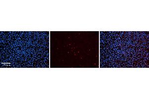 Rabbit Anti-Ppara Antibody  Catalog Number: ARP34068_P050 Formalin Fixed Paraffin Embedded Tissue: Human Adult liver  Observed Staining: Nuclear and some weak cytoplasmic Primary Antibody Concentration: 1:600 Secondary Antibody: Donkey anti-Rabbit-Cy2/3 Secondary Antibody Concentration: 1:200 Magnification: 20X Exposure Time: 0. (PPARA antibody  (C-Term))