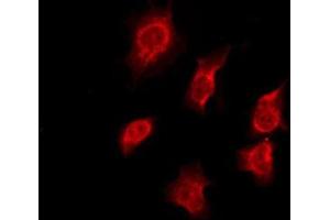 ABIN6276186 staining HeLa by IF/ICC. (OR7C1 antibody  (Internal Region))