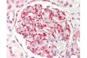 Human Kidney: Formalin-Fixed, Paraffin-Embedded (FFPE). (EIF6 antibody  (AA 145-194))