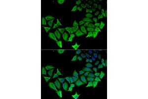Immunofluorescence analysis of HeLa cells using APLP1 antibody. (APLP1 antibody  (AA 39-300))