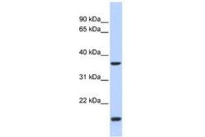 Image no. 1 for anti-Zic Family Member 4 (ZIC4) (N-Term) antibody (ABIN6740619)