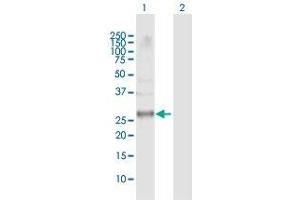 Western Blotting (WB) image for anti-Cyclin-Dependent Kinase 20 (CDK20) (AA 1-275) antibody (ABIN525247)