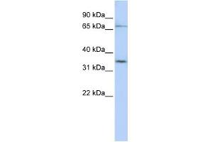 WB Suggested Anti-SLCO1C1 Antibody Titration:  0. (SLCO1C1 antibody  (N-Term))