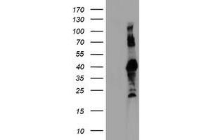 HEK293T cells were transfected with the pCMV6-ENTRY control (Left lane) or pCMV6-ENTRY RNF113B (Right lane) cDNA for 48 hrs and lysed. (RNF113B antibody)