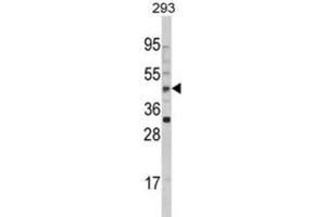 Western Blotting (WB) image for anti-Arylacetamide Deacetylase (Esterase) (AADAC) antibody (ABIN3002812) (AADAC antibody)
