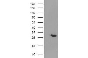 HEK293T cells were transfected with the pCMV6-ENTRY control (Left lane) or pCMV6-ENTRY GSTT2 (Right lane) cDNA for 48 hrs and lysed. (GSTT2 antibody)