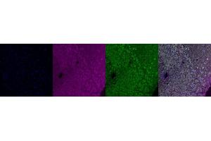 Immunohistochemistry (IHC) image for anti-Connective Tissue Growth Factor (CTGF) antibody (ABIN7456268)