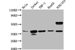 Western blot All lanes: CLYBL antibody at 1 μg/mL Lane 1: Hela whole cell lysate Lane 2: NIH/3T3 whole cell lysate Secondary Goat polyclonal to rabbit IgG at 1/10000 dilution Predicted band size: 38, 34 kDa Observed band size: 38 kDa (CLYBL antibody  (AA 23-340))
