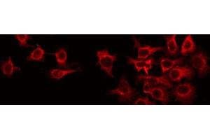 ABIN6266631 staining Hela by IF/ICC. (RIT1 antibody  (C-Term))