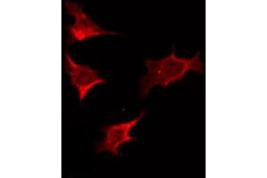 ABIN6274790 staining HT29 by IF/ICC. (ABHD2 antibody  (Internal Region))