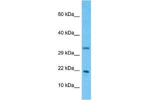 Host:  Rabbit  Target Name:  NDUFB11  Sample Type:  Hela Whole Cell lysates  Antibody Dilution:  1. (NDUFB11 antibody  (N-Term))