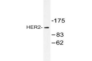 Western blot analysis of HER2 antibody in extracts from 293 cells. (ErbB2/Her2 antibody)