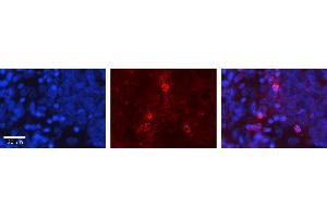 Rabbit Anti-GNA12 Antibody Catalog Number: ARP54813_P050 Formalin Fixed Paraffin Embedded Tissue: Human Ovary Tissue Observed Staining: Plasma membrane Primary Antibody Concentration: 1:100 Other Working Concentrations: 1:600 Secondary Antibody: Donkey anti-Rabbit-Cy3 Secondary Antibody Concentration: 1:200 Magnification: 20X Exposure Time: 0. (GNA12 antibody  (Middle Region))