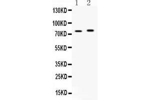 Western blot analysis of ACSL5 expression in rat brain extract ( Lane 1) and mouse brain extract ( Lane 2). (ACSL5 antibody  (Middle Region))