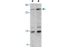 Western blot analysis of NKIRAS1 in 293 cell lysate with NKIRAS1 polyclonal antibody  at 2 and 4 ug/mL . (NKIRAS1 antibody  (Internal Region))