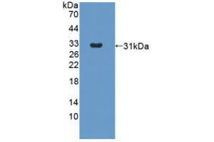 Western blot analysis of recombinant Rabbit ANGPT2. (Angiopoietin 2 antibody)