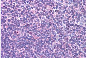 Human Lymph Node (formalin-fixed, paraffin-embedded) stained with DCLRE1C antibody ABIN298129 at 1. (DCLRE1C antibody  (AA 482-495))