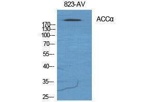Western Blotting (WB) image for anti-Acetyl-CoA Carboxylase alpha (ACACA) (Ser122) antibody (ABIN3183142) (Acetyl-CoA Carboxylase alpha antibody  (Ser122))