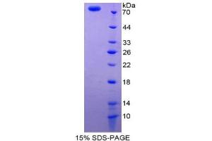 SDS-PAGE (SDS) image for Vitamin D-Binding Protein (GC) (AA 17-476) protein (His tag,GST tag) (ABIN1980999)
