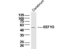 Lane 1:Mouse cerebellum lysates probed with EEF1G Polyclonal Antibody, Unconjugated  at 1:300 overnight at 4˚C. (EEF1G antibody  (AA 251-350))