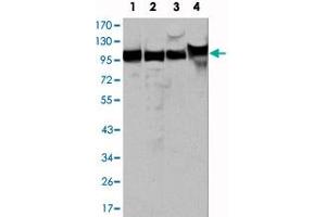 Western blot analysis using MSH2 monoclonal antibody, clone 1B3 (3A2B8C)  against HeLa (1), A-549 (2), A-431 (3) and HEK293 (4) cell lysate. (MSH2 antibody)